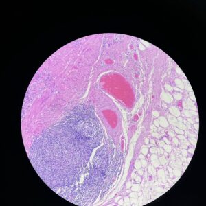 Hematoxylin and Eosin stain pictures